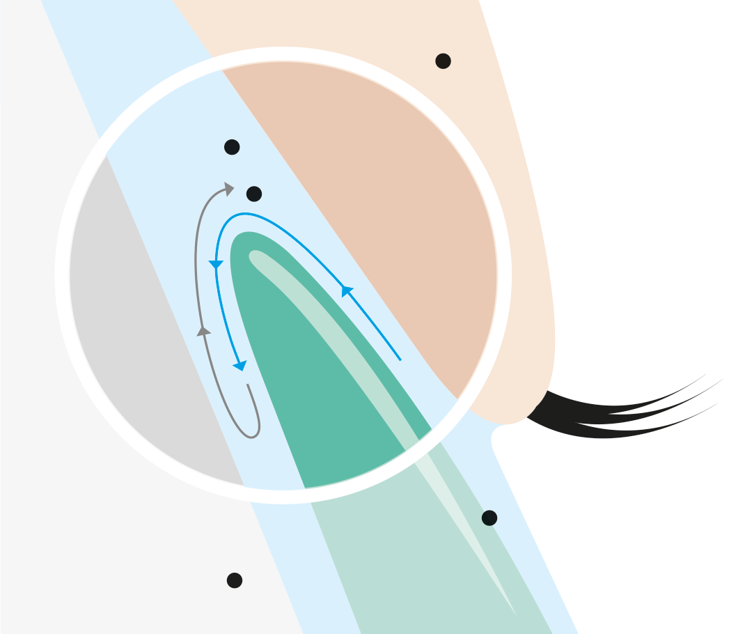 Infografik von Woehlk Contactlinsen